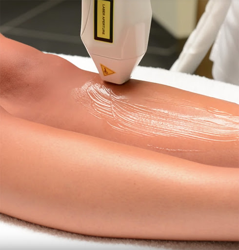 Laser Hair Removal & IPL Training Courses Level 4 - Image 5